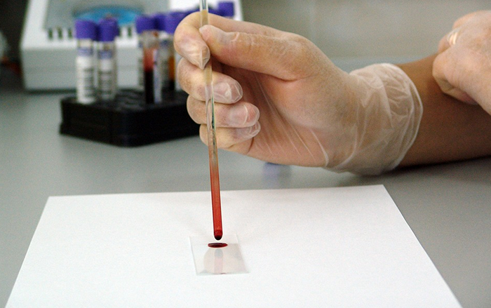 Coronavirus, buone notizie dal Piemonte, negativi ai test i tre cinesi di Cuneo. Su 45 test nessun infetto